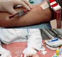 Čo je krvný test určuje červami u dieťaťa a dospelého všeobecnú IFA, ze žily?