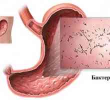 Akútne infekčné gastroenteritída