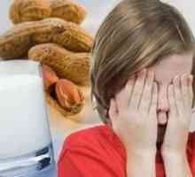 Potravinové alergie u detí starších ako 7 rokov