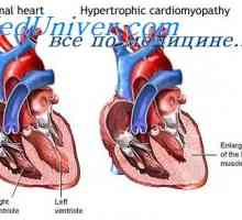 Sval prietok krvi. Hypertrofia srdca počas tréningu