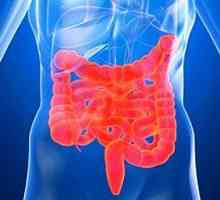 Príznaky syndrómu dráždivého čreva (IBS)