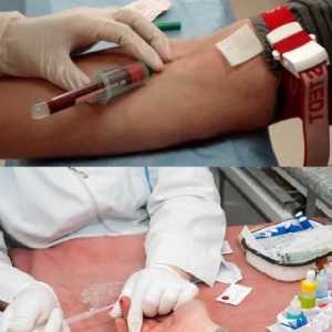 Čo je krvný test určuje červami u dieťaťa a dospelého všeobecnú IFA, ze žily?